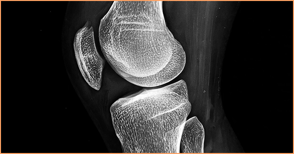 Detaillierte MRT-Aufnahme eines Kniegelenks, die präzise anatomische Strukturen zur Analyse des linken und rechten Knies im automatisierten System von ScanDiags zeigt.